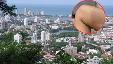 Photo of Alerta en Cartagena por virus Coxsackie: advierte sobre síntomas y propagación en niños